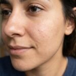 Skin Pores
